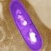 Fotografía al microscopio electrónico de la bacteria causante de la listeriosis